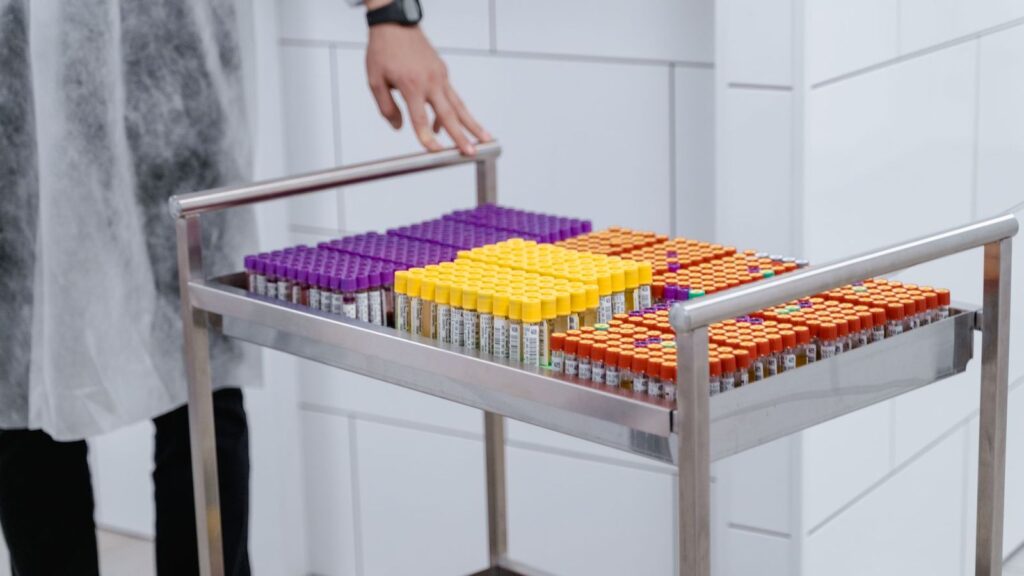 Blood sample tubes on a laboratory trolley, like the HIV test needed before starting PrEP