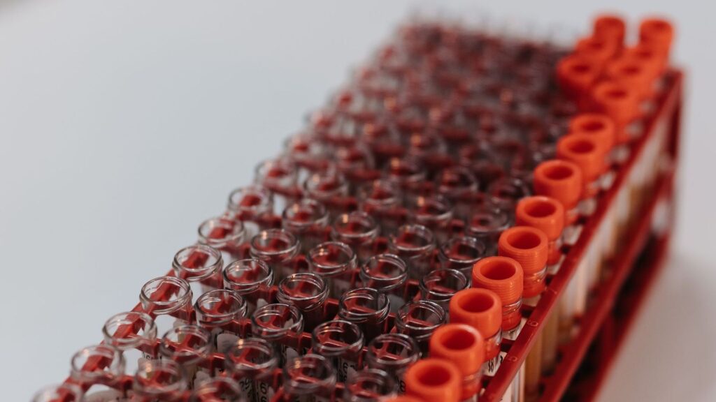 Blood sample tubes in a laboratory rack, ready for HIV testing