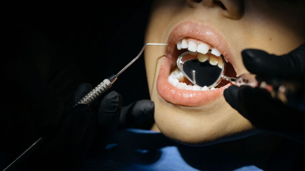 Dentist examining teeth with a mouth mirror; gum disease and mouth ulcers can affect HIV risk
