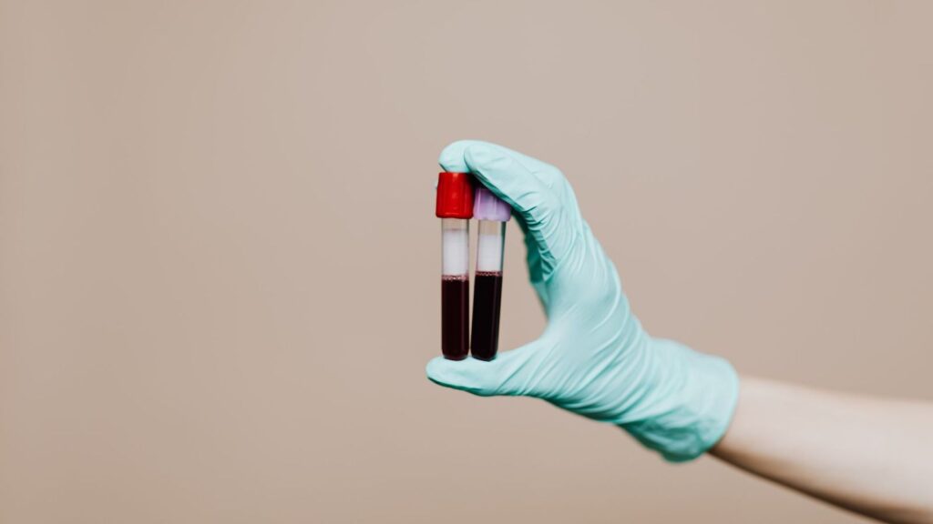Gloved hand holding two blood sample tubes for a follow-up HIV test