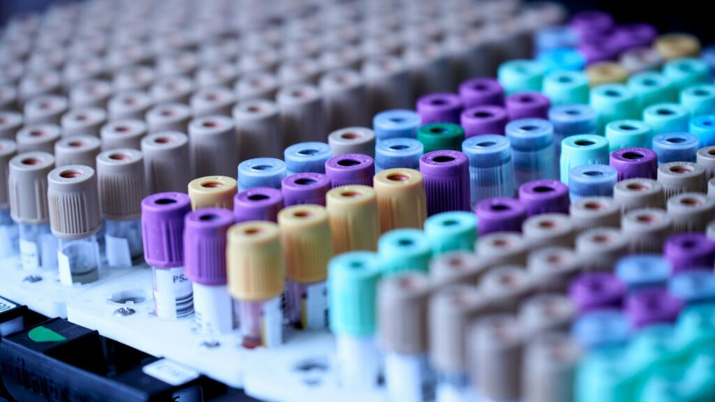 Labelled sample tubes in a rack, prepared for follow-up HIV tests after finishing PEP