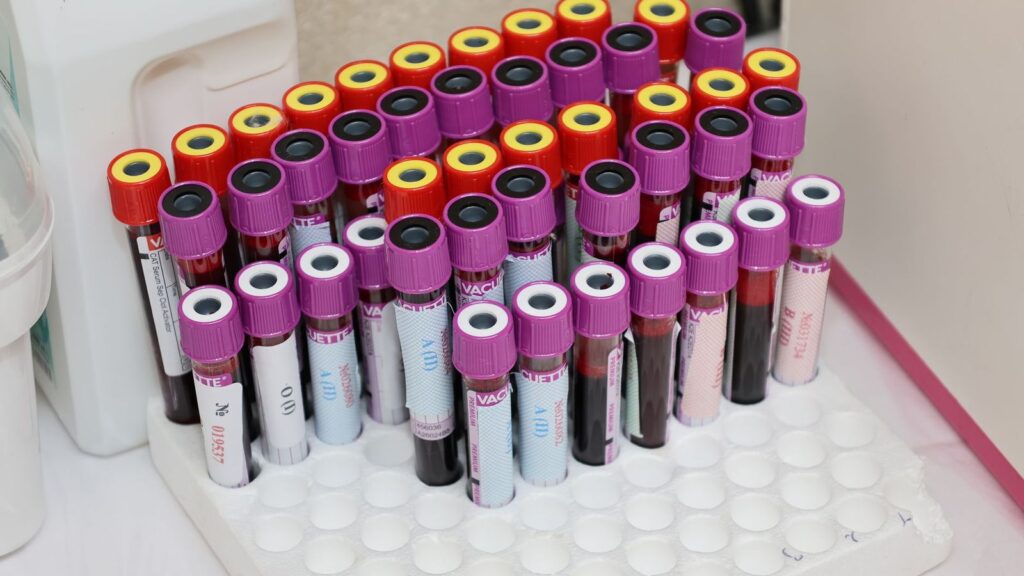 Labelled sample tubes ready for HIV and STI testing in a clinic laboratory