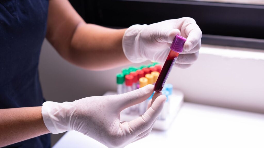 Nurse in gloves preparing tubes to take a blood sample from a vein