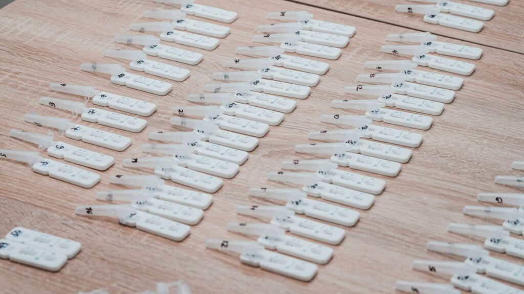 Rapid HIV test cassette on a clinic table, the kind of test that gives a result in about an hour