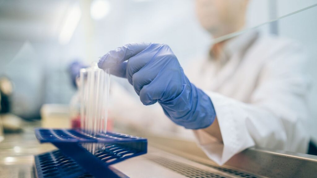 Scientist working with sample tubes in a laboratory where HIV tests are processed