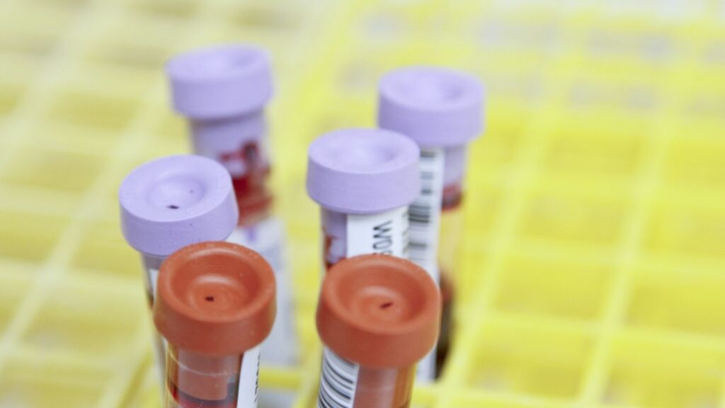 Labelled sample tubes in a rack, ready for STI testing in the laboratory